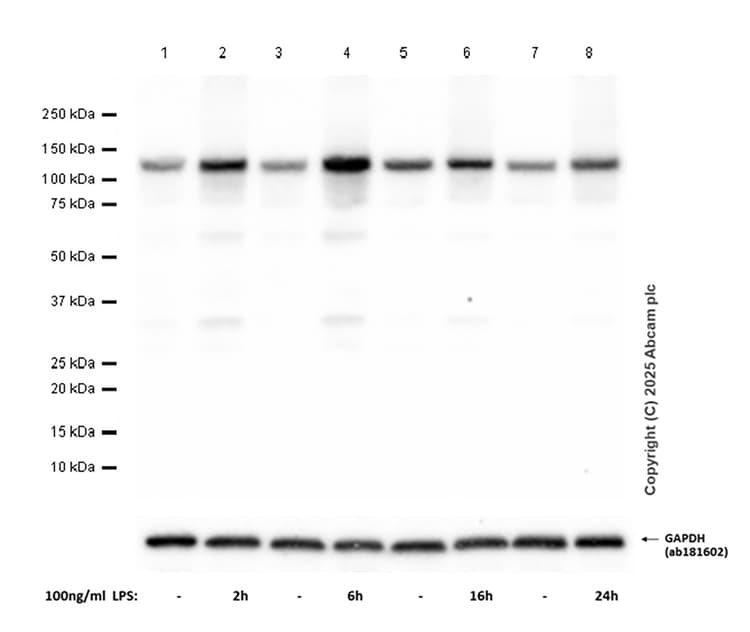 Anti-NLRP3 antibody [RM1021](AB283819)