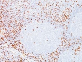 Anti-CD8 alpha antibody [C8/468](AB233995)