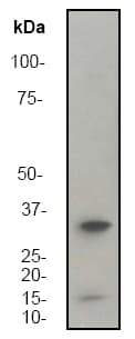 Anti-DARPP32 antibody [EP720Y](AB40801)