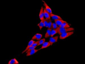 Anti-Fbx32 antibody [EPR9148(2)](AB168372)