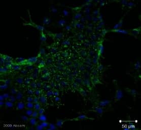 Anti-SSEA4 antibody [MC813-70](AB16287)