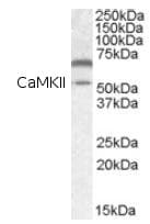 Camkii Alpha Antibody Ab87597  Western Blot Img2220