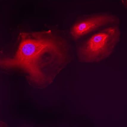 Anti-LMAN1 antibody(AB32583)