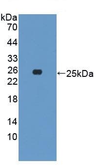 Growth Hormone Antibody Ab230996  Western Blot Img10854