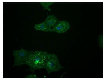 Anti-LGR5 antibody [OTI2A2](AB273092)
