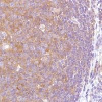 Vpac2 Antibody Sp235 Bsa And Azide Free Ab246352  Immunohistochemistry Formalin Pfa Fixed Paraffin Embedded Sections Img108040