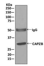 Capzb Antibody Epr10236 Ab175212  Immunoprecipitation Img60321