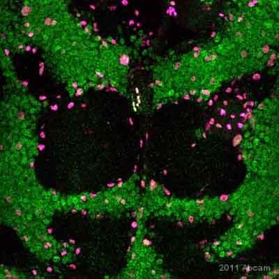 Anti-beta Galactosidase antibody(AB9361)