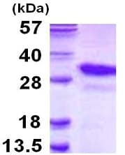 Ab116154  Sds Page Img39936