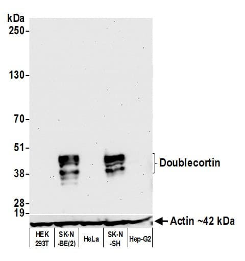 Anti-Doublecortin antibody [BLR168J] - BSA free(AB314076)