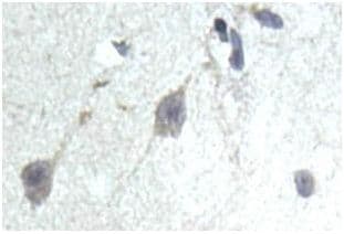 Pcb Antibody Ab196277  Immunohistochemistry Formalin Pfa Fixed Paraffin Embedded Sections Img94297