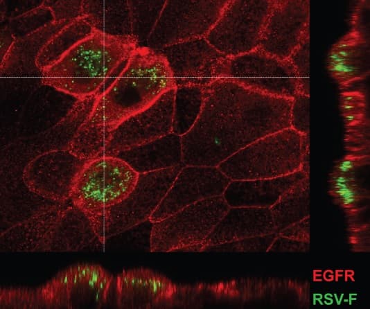 Anti-EGFR (phospho Y1068) antibody [EP774Y](AB40815)