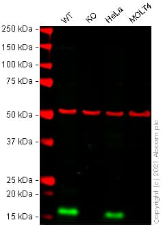 Perp Antibody Epr7885 Bsa And Azide Free Ab248288  Western Blot Img168917