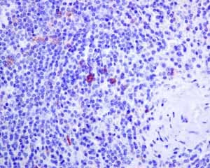 Il 2 Receptor Alpha Antibody Epr6452 Ab128955  Immunohistochemistry Formalin Pfa Fixed Paraffin Embedded Sections Img96320