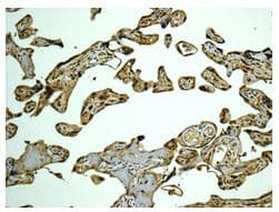 Capzb Antibody Epr10236 Ab175212  Immunohistochemistry Formalin Pfa Fixed Paraffin Embedded Sections Img132954