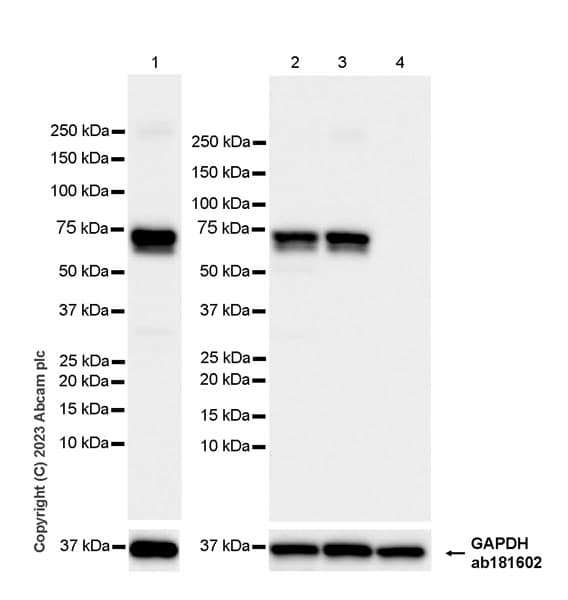 68kda Neurofilament Nf L C Term Antibody Epr28784 63 Bsa And Azide Free Ab315815  Western Blot Img425397