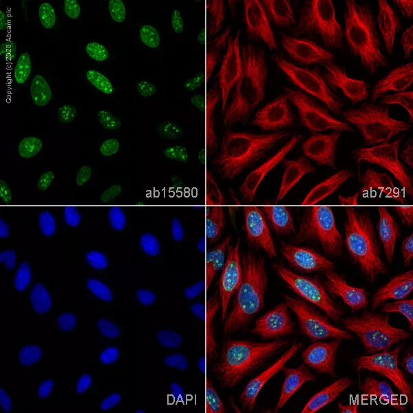 Anti-Ki67 Antibody ab15580 Polyclonal | Danaher Life Sciences