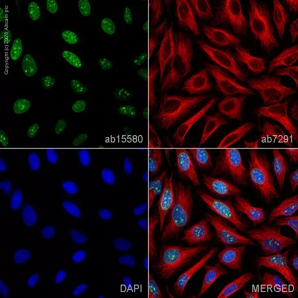 Anti-Ki67 antibody(AB15580)