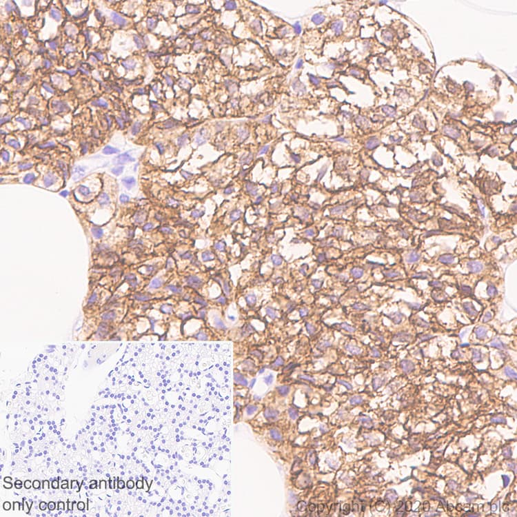 Casr Antibody Epr24050 59 Bsa And Azide Free Ab280360  Immunohistochemistry Formalin Pfa Fixed Paraffin Embedded Sections Img129911