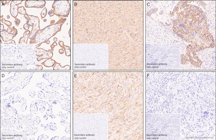 Egfrviii Antibody Epr28380 83 Bsa And Azide Free Ab313647  Immunohistochemistry Formalin Pfa Fixed Paraffin Embedded Sections Img418459