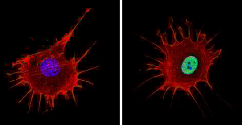 Anti-NCOR2/SMRT antibody(ab5802)