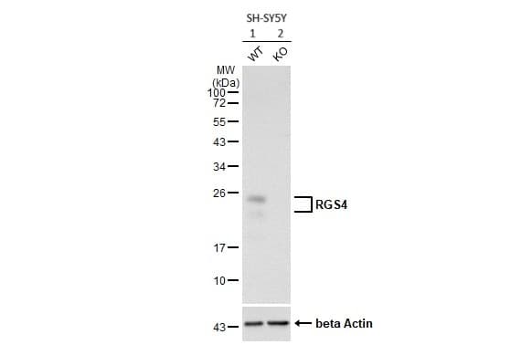 Rgs4 Antibody Hl1522 Ab308160  Western Blot Img441314