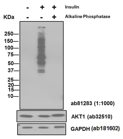 Anti-AKT1 (phospho S473) antibody [EP2109Y](AB81283)