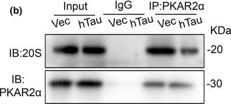 Anti-Proteasome 20S LMP2 antibody [EPR22042](AB242061)