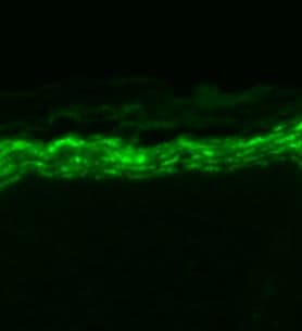 Anti-Nav1.7 antibody [N68/6](AB85015)