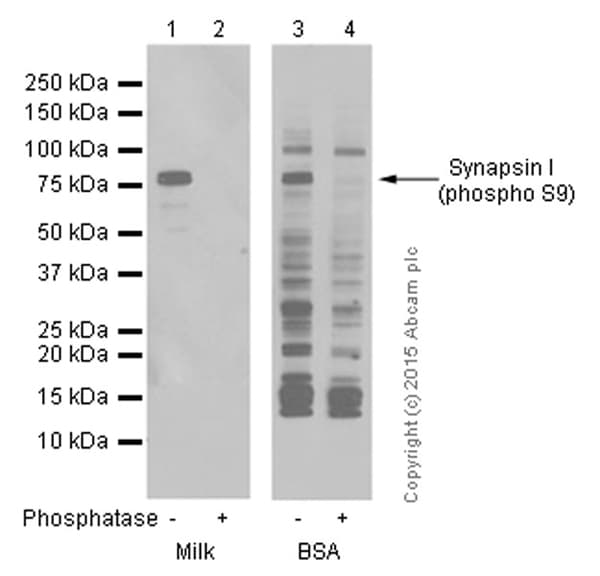 Synapsin I Phospho S9 Antibody Ep2162y Ab76260  Western Blot Img10966
