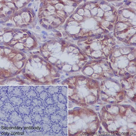 Autophagy Analysis (ATG16L1, ATG16L1 pS278, SQSTM1, LC3B, Ubiquitin, M6PR) Antibody Sampler Panel(AB269811)