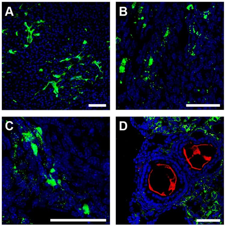 Anti-Fade Fluorescence Mounting Medium - Aqueous, Fluoroshield(AB104135)