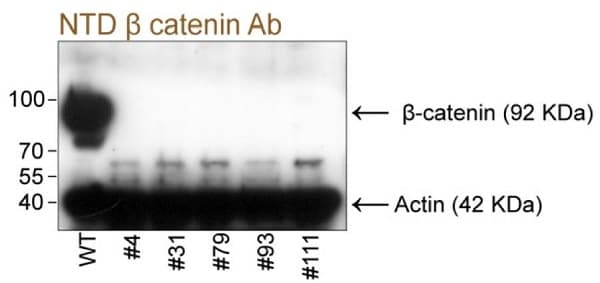 Anti-beta Catenin antibody [E247] - ChIP Grade(AB32572)