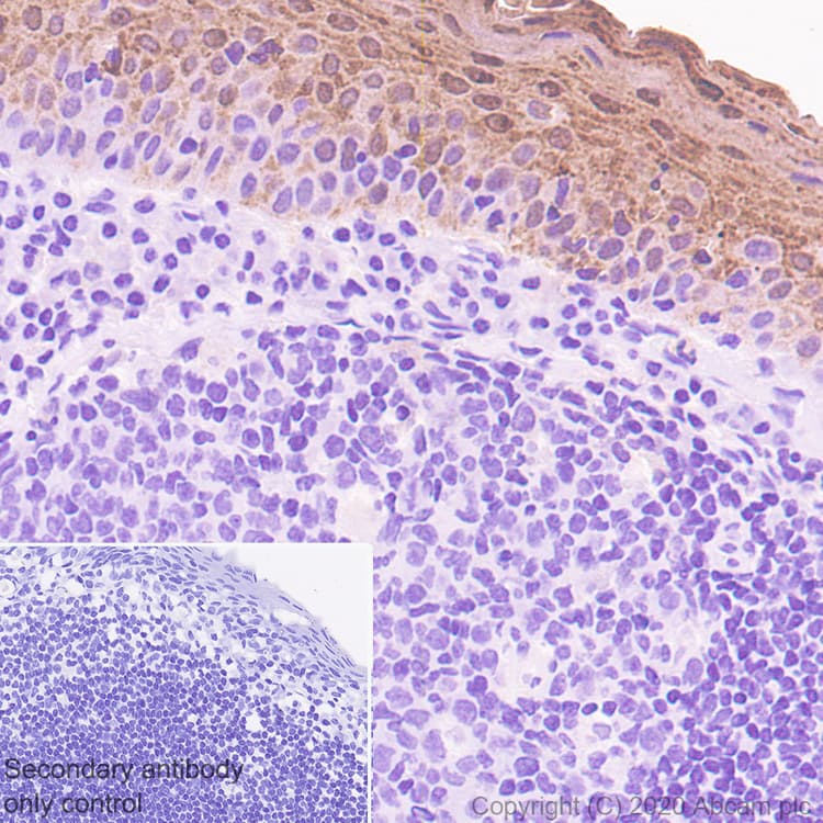 Psoriasin Antibody Epr23482 38 Ab275026  Immunohistochemistry Formalin Pfa Fixed Paraffin Embedded Sections Img64369
