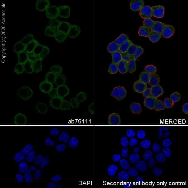 Anti-beta Synuclein antibody [EP1537Y] - BSA and Azide free(AB221908)