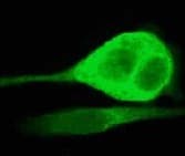 Mek2 Antibody Y78 Ab32517  Immunocytochemistry Immunofluorescence Img12944