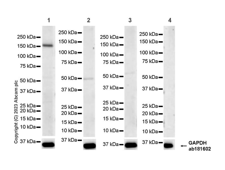 Kiaa1199 Antibody Epr27442 24 Ab308288  Western Blot Img409551