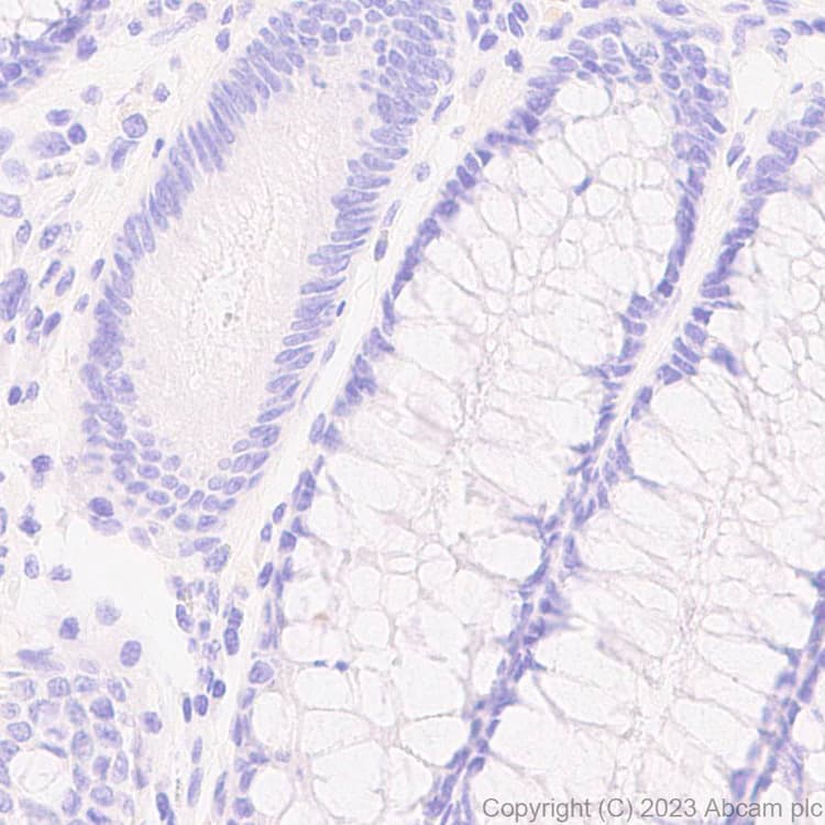 Anti-Mycobacterium tuberculosis Ag85B antibody [EPR28401-54] - BSA and Azide free(AB312329)