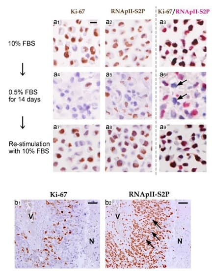 Anti-Ki67 antibody [EPR3610](AB92742)