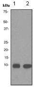 Anti-Trefoil Factor 3 antibody [EPR3974](AB108599)