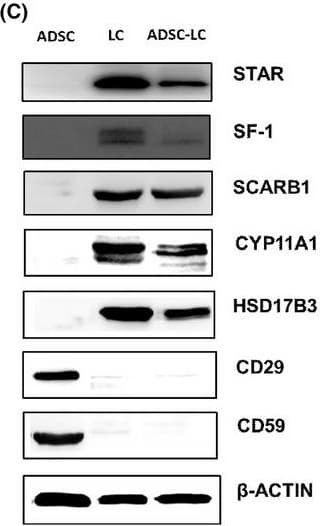 Anti-StAR antibody [EP7639](AB133657)