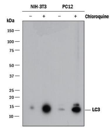 Anti-LC3B antibody - Autophagosome Marker(AB48394)