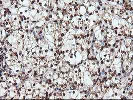 Samhd1 Antibody Oti1a1 Ab128107  Immunohistochemistry Formalin Pfa Fixed Paraffin Embedded Sections Img104998