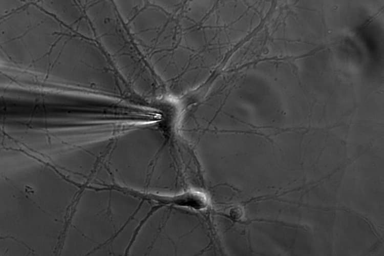 Dm6 Fs Cullt Neuron Kid21757552
