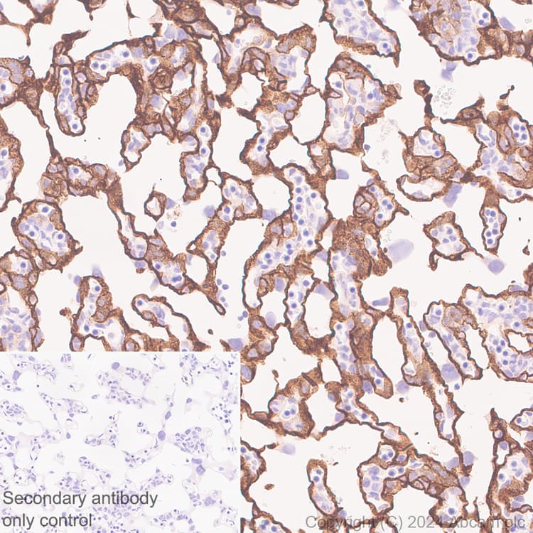Lox 1 Antibody Epr27871 67 Bsa And Azide Free Ab317690  Immunohistochemistry Formalin Pfa Fixed Paraffin Embedded Sections Img432110