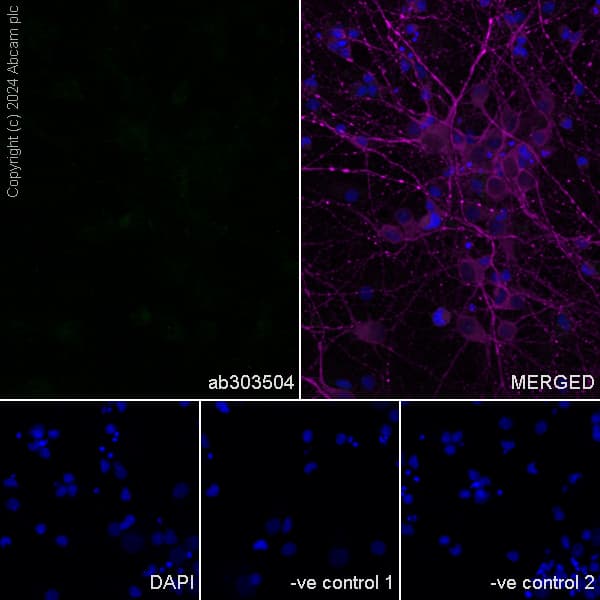 Anti-ABCA4 antibody [EPR26543-66](AB303504)