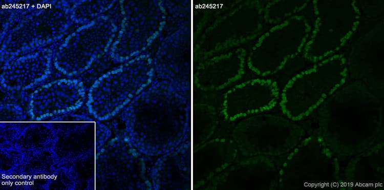 Anti-DMC1 antibody [EPR23207-130](AB245217)