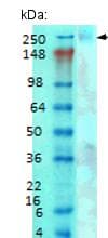 Cacna1g Antibody N178a 9 Ab134269  Western Blot Img38435