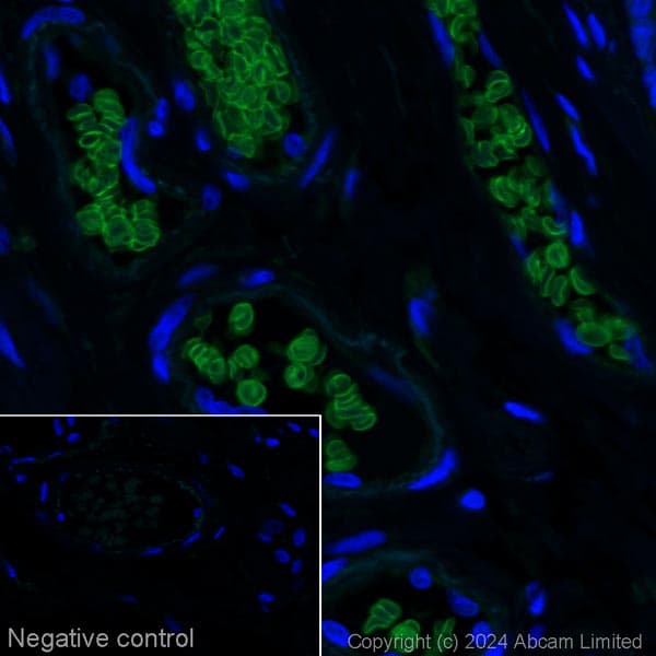 Alexa Fluor 488 Band 3 Ae 1 Antibody Epr1426 Ab225081  Immunohistochemistry Formalin Pfa Fixed Paraffin Embedded Sections Img440182
