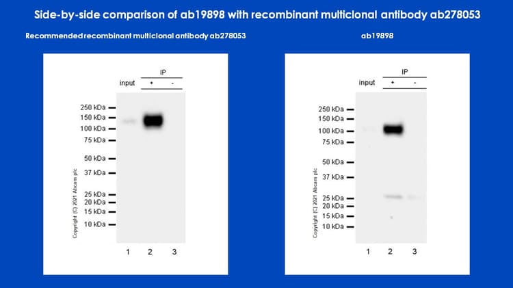 Anti-CD133 antibody - Stem Cell Marker(AB19898)